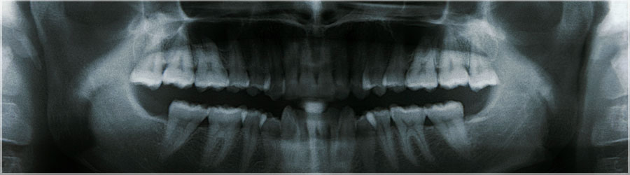 Dentition, ne faites pas attention au cerveau ! Dentition, ne regardez pas le zénith ! www.360x180.fr Selme Matthieu